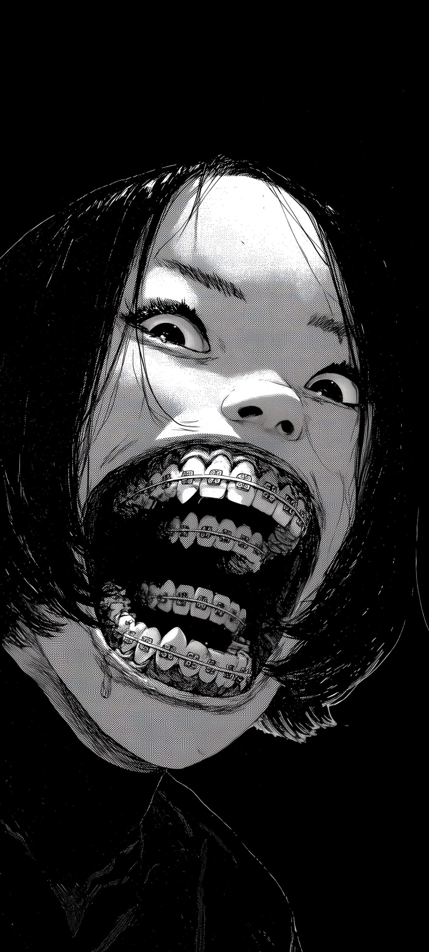 Braces #1