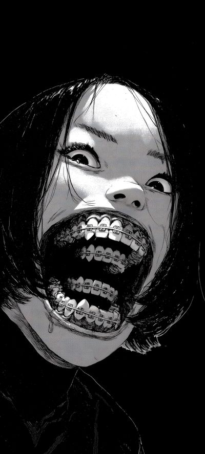 Braces #1